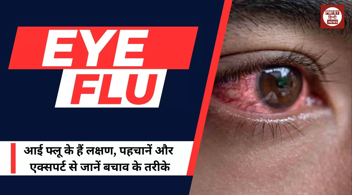 eye-flu-information-eye-flu-major-types-symptoms-causes-domestic